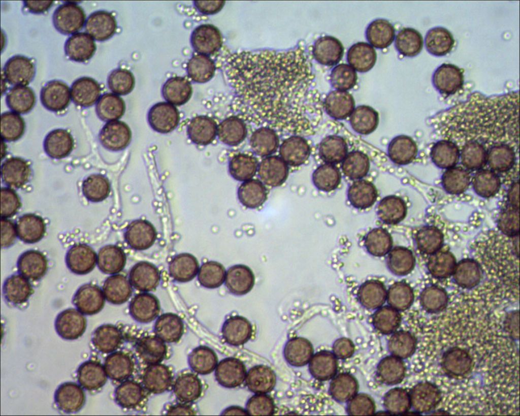 Badhamia or Physarum?